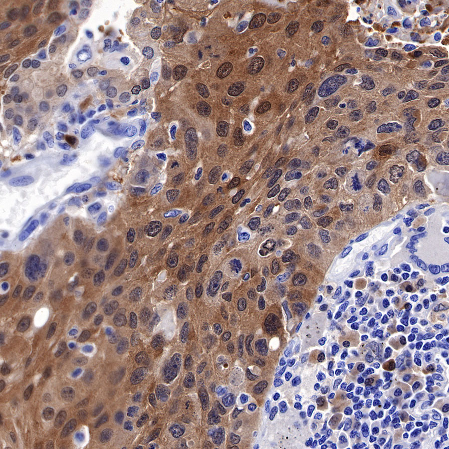 Rabbit anti-GST-π Recombinant Monoclonal Antibody(561-78)