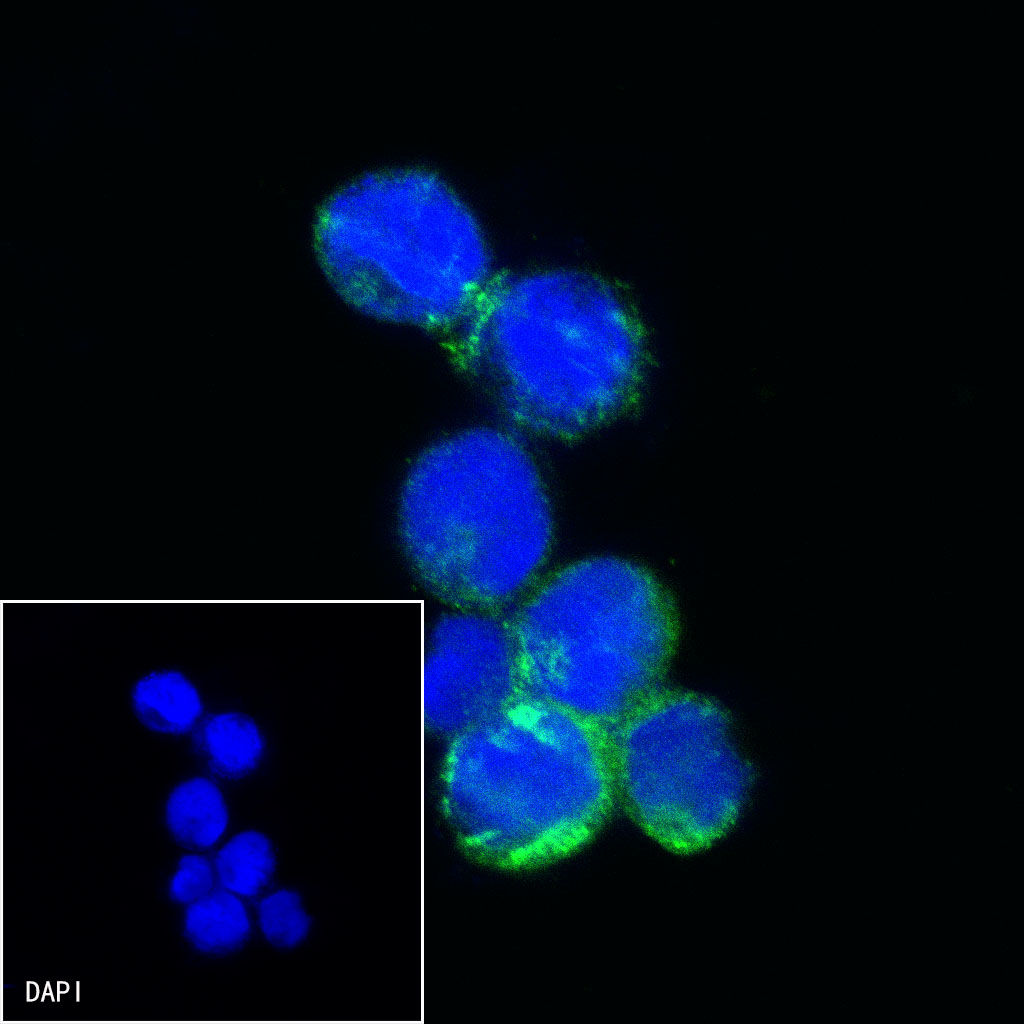 Rabbit anti-CHI3L1 Recombinant Monoclonal Antibody(S-324-38)