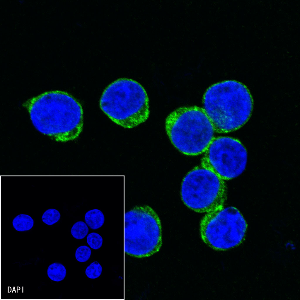 Mouse anti-CD2 Monoclonal Antibody(S-633-25)