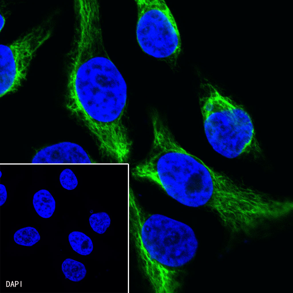 Rabbit anti-Vimentin Recombinant Monoclonal Antibody(AF488 Conjugate)(S-029-20)