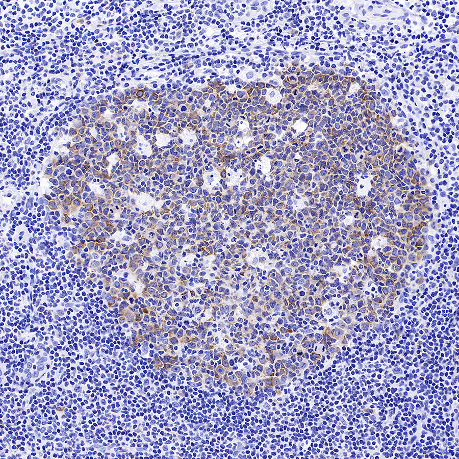 Rabbit anti-IMP-3 Recombinant Monoclonal Antibody(S-439-10)