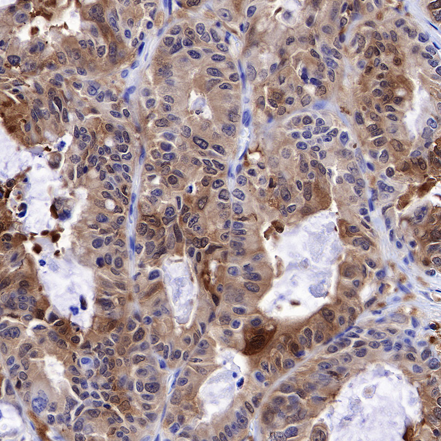 Rabbit anti-GST-π Recombinant Monoclonal Antibody(561-78)