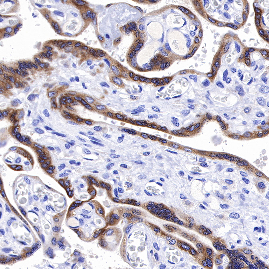 Rabbit anti-IMP-3 Recombinant Monoclonal Antibody(S-439-10)