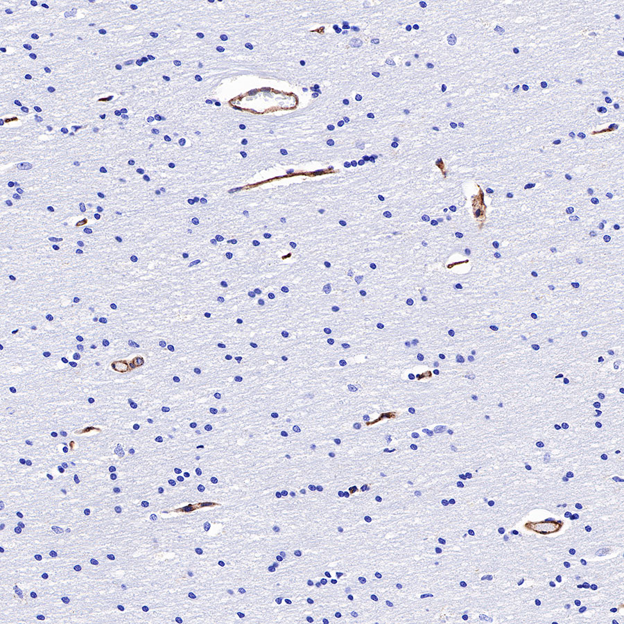 Rabbit anti-BST2 Recombinant Monoclonal Antibody(S-534-103)