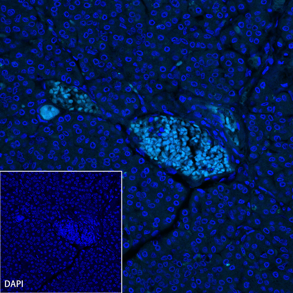 Rabbit anti-NKX6.1 Recombinant Monoclonal Antibody(S-260-31)