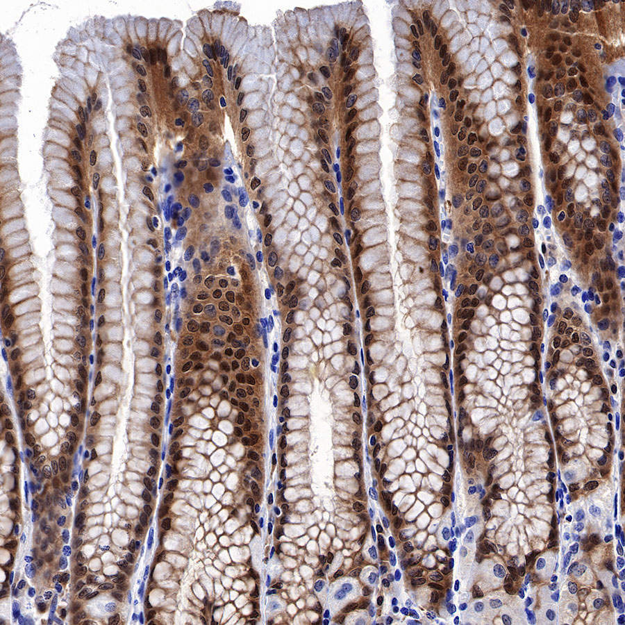 Rabbit anti-GST-π Recombinant Monoclonal Antibody(561-78)