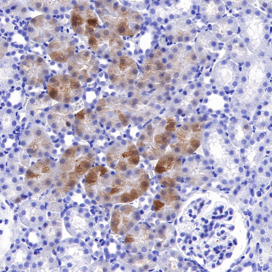 Rabbit anti-GST-π Recombinant Monoclonal Antibody(561-78)
