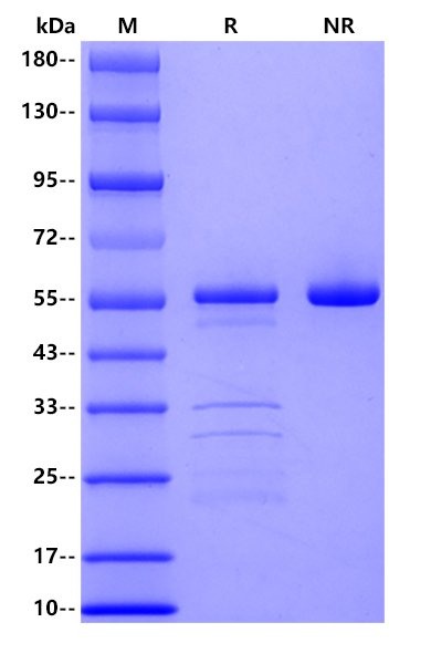 Recombinant Canine Pancreatic Lipase Protein(C-10His)