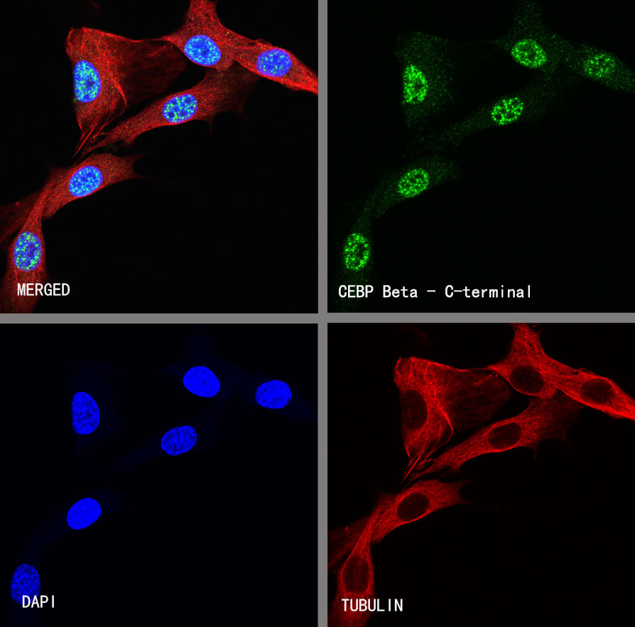 Rabbit anti-CEBP β Recombinant Monoclonal Antibody(C-term)(S-773-48)