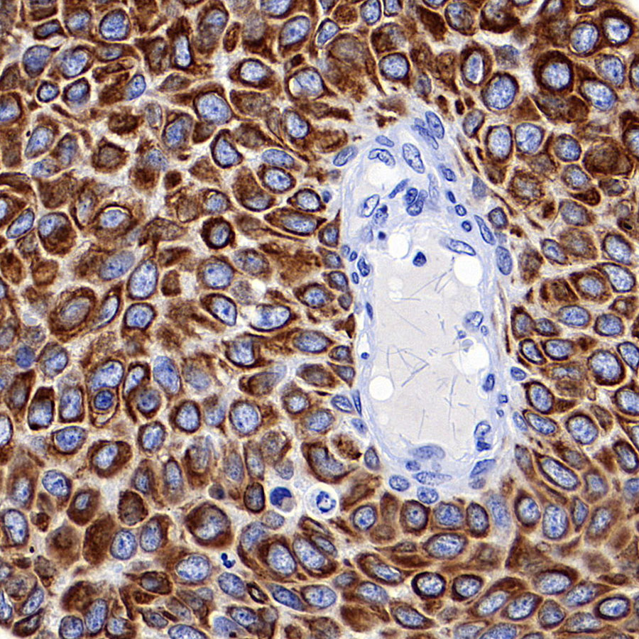 Rabbit anti-Keratin 16 Recombinant Monoclonal Antibody(S-R306)