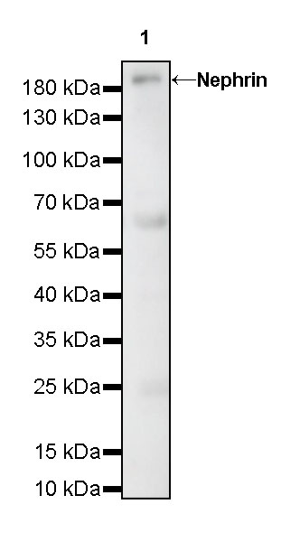 Rabbit anti-Nephrin Recombinant Monoclonal Antibody(S-543-63)