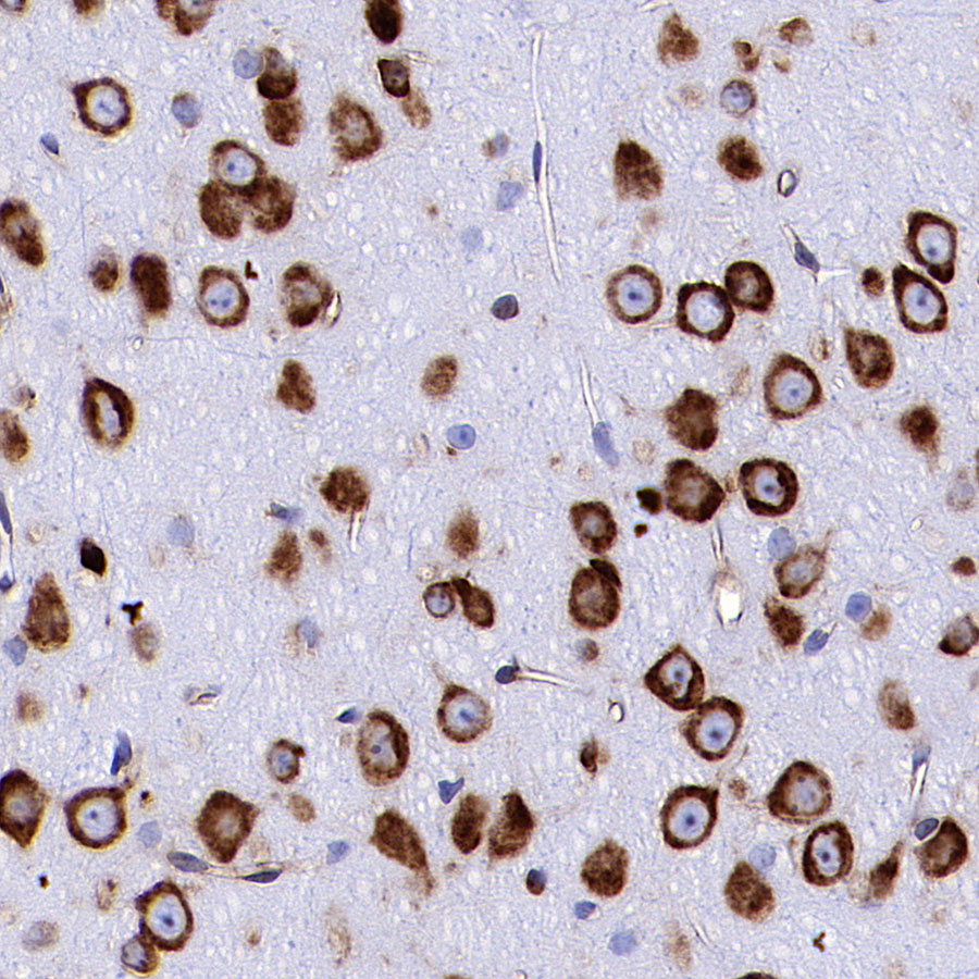 Rabbit anti-BID Recombinant Monoclonal Antibody(S-R300)