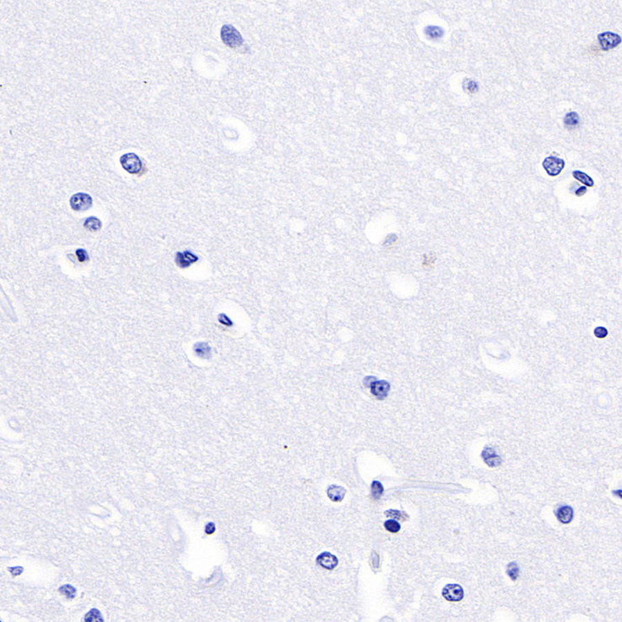 Rabbit anti-Luteinizing Hormone β Recombinant Monoclonal Antibody(545-2)