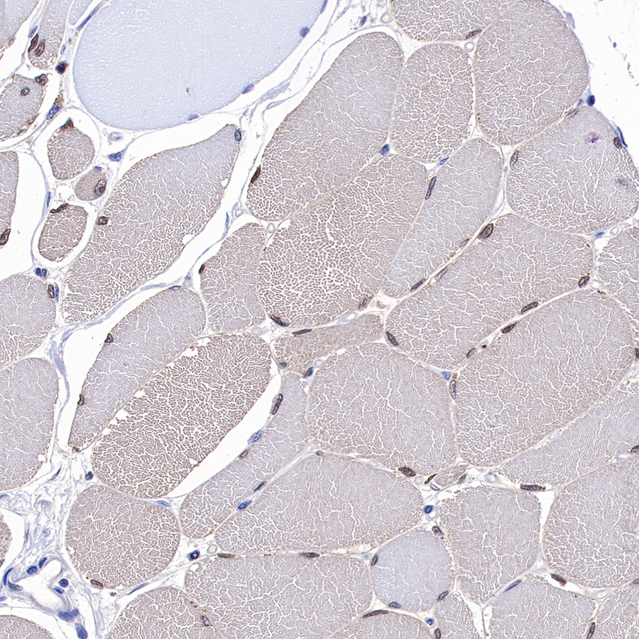 Rabbit anti-MEK3 Recombinant Monoclonal Antibody(S-835-23)