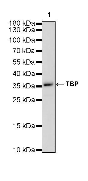 Rabbit anti-TBP Recombinant Monoclonal Antibody(S-886-57)