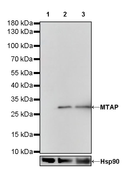 Rabbit anti-MTAP Recombinant Monoclonal Antibody(S-R363)
