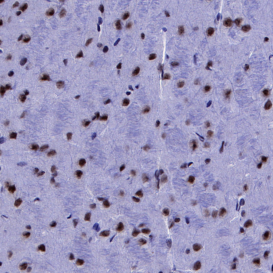 Rabbit anti-p27 Recombinant Monoclonal Antibody(S-141-135)