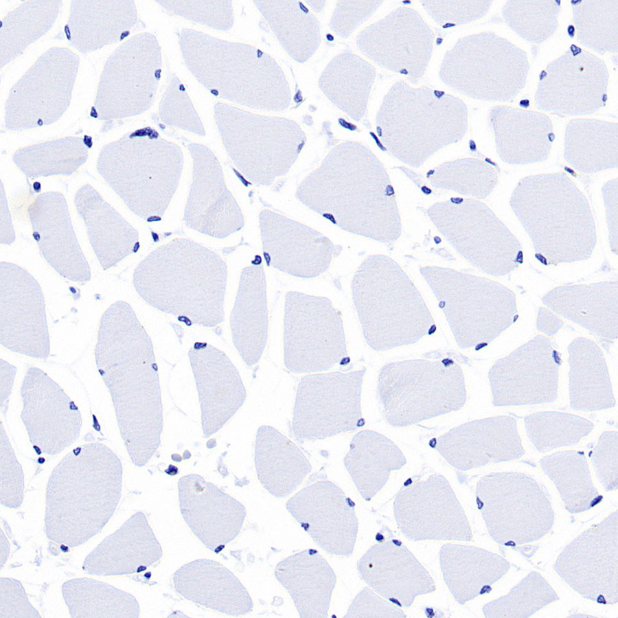 Rabbit anti-Keratin 16 Recombinant Monoclonal Antibody(S-R306)