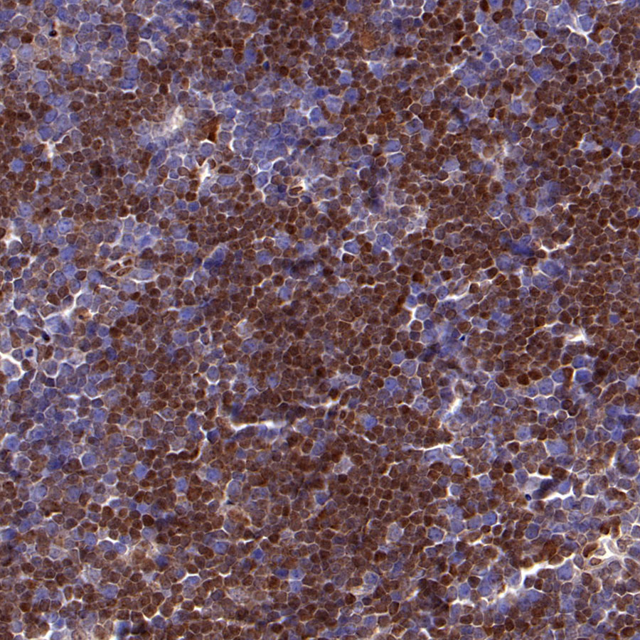 Rabbit anti-p27 Recombinant Monoclonal Antibody(S-141-135)