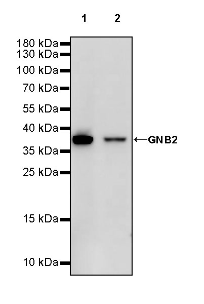 Rabbit anti-GNB2 Recombinant Monoclonal Antibody(S-645-10)