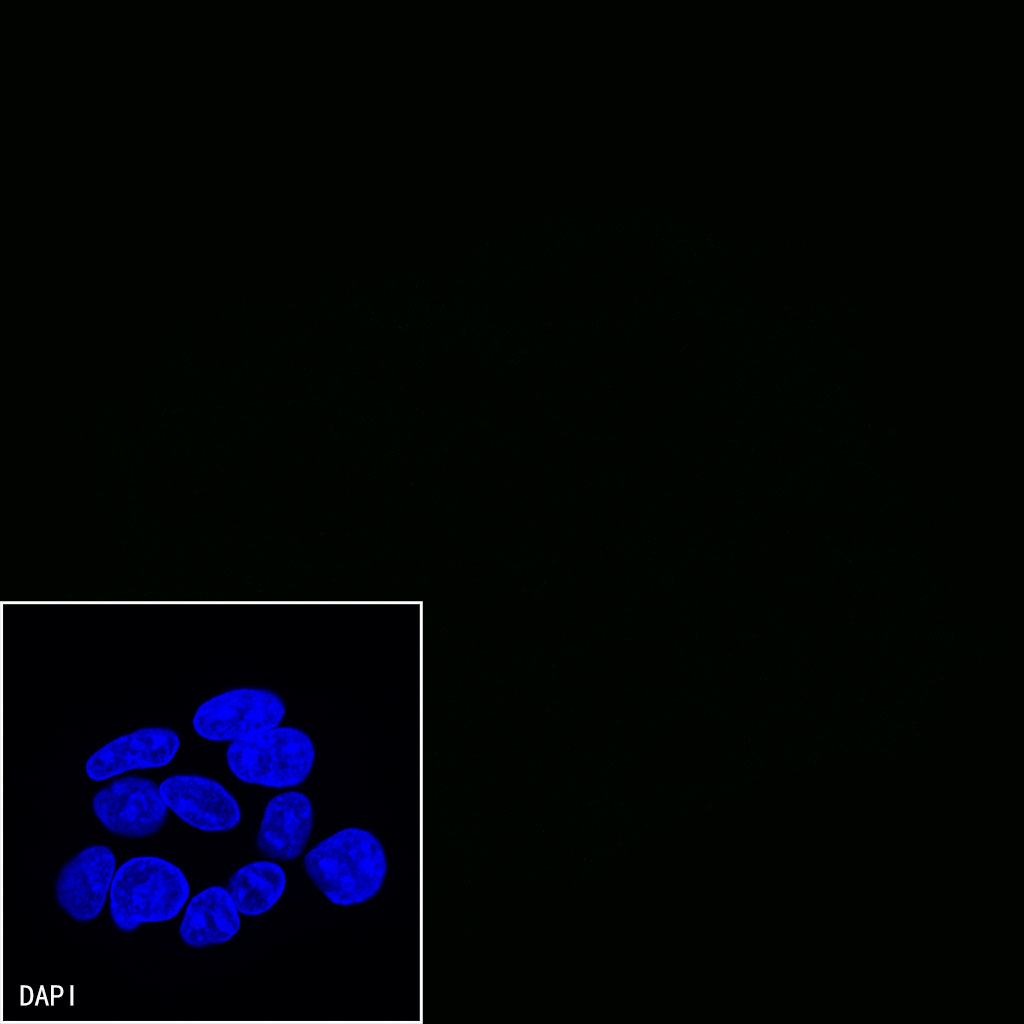 Mouse anti-CD47 Monoclonal Antibody(S-823-72)