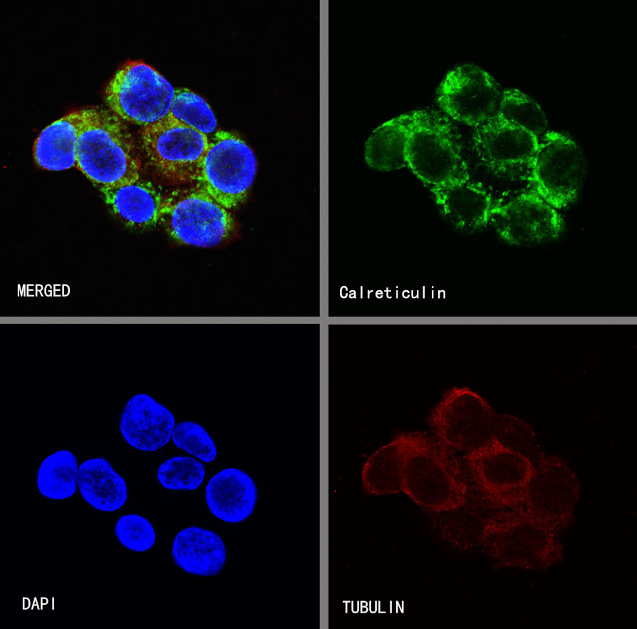 Rabbit anti-Calreticulin Recombinant Monoclonal Antibody(S-R353)