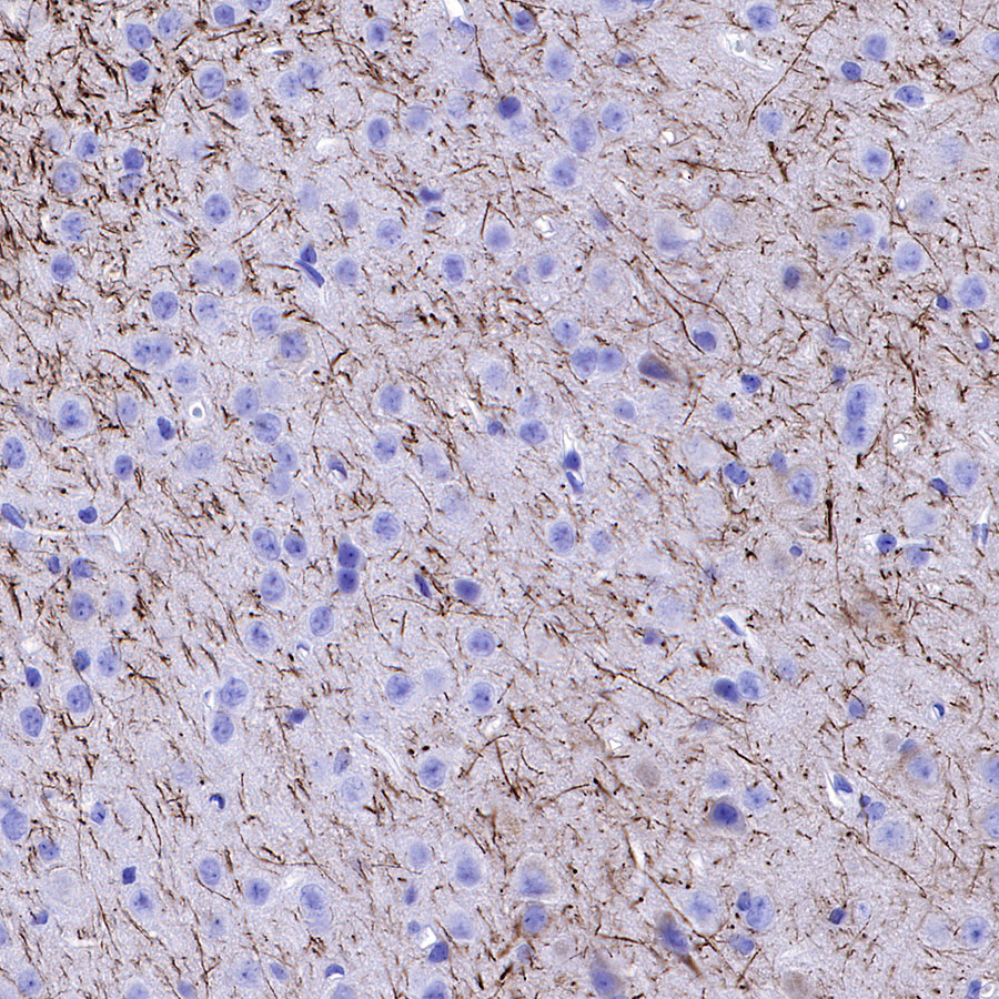Rabbit anti-Neurofilament H Recombinant Monoclonal Antibody(S-532-103)