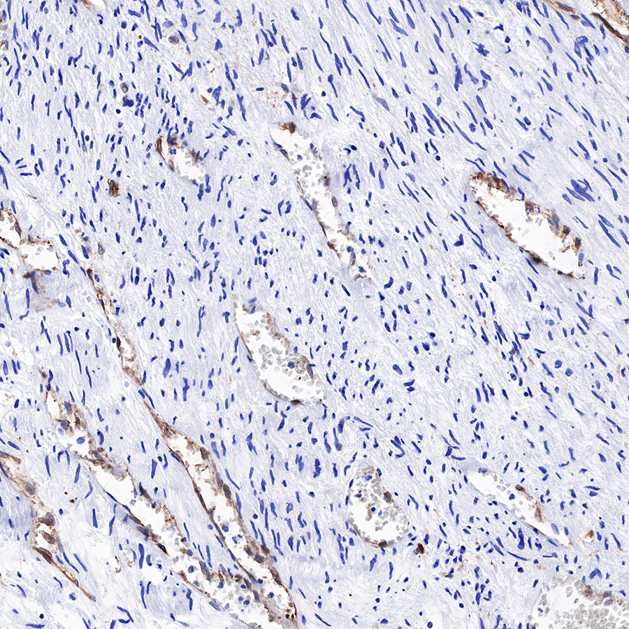 Rabbit anti-Fascin Recombinant Monoclonal Antibody(S-759-13)