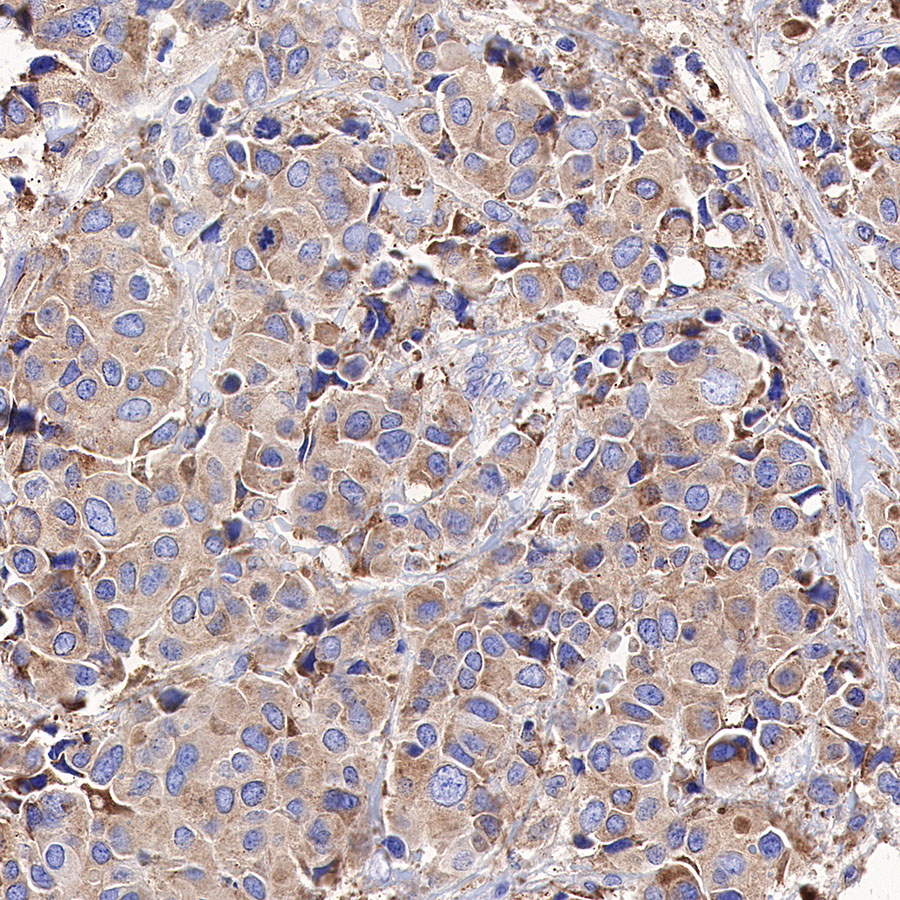 Rabbit anti-Calreticulin Recombinant Monoclonal Antibody(S-R353)