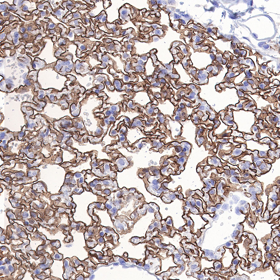 Rabbit anti-Fascin Recombinant Monoclonal Antibody(S-759-13)