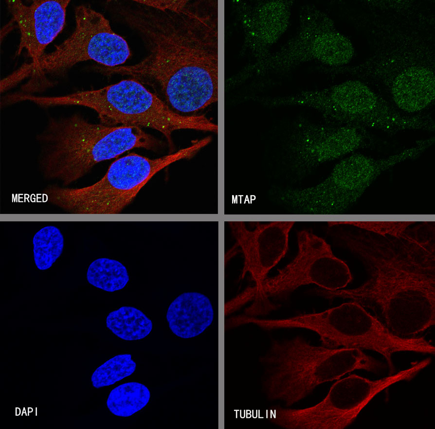 Rabbit anti-MTAP Recombinant Monoclonal Antibody(S-R363)