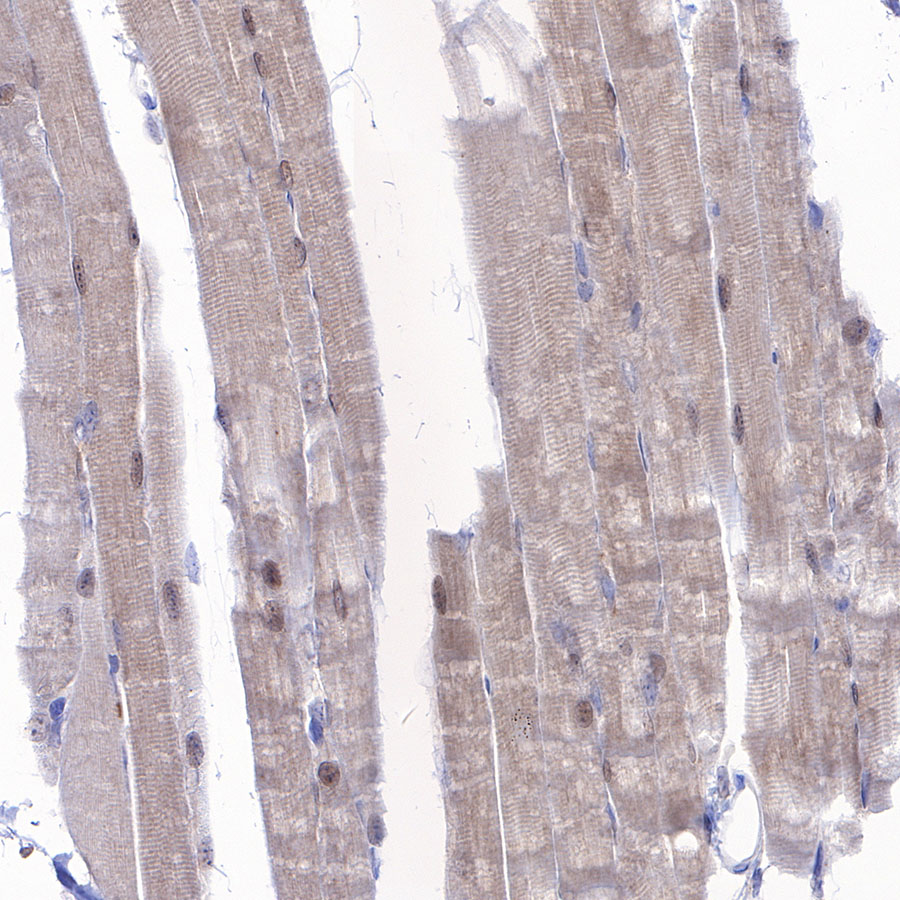 Rabbit anti-MEK3 Recombinant Monoclonal Antibody(S-835-23)