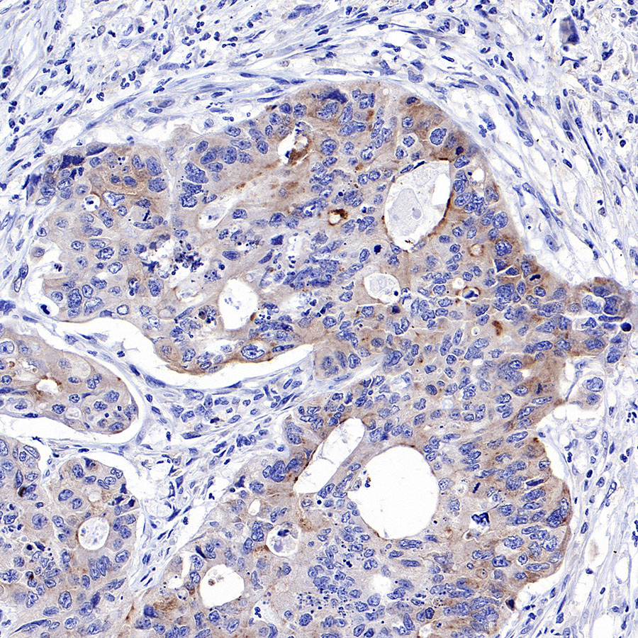 Rabbit anti-IGFBP2 Recombinant Monoclonal Antibody(S-808-24)