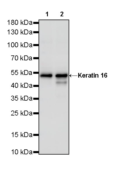 Rabbit anti-Keratin 16 Recombinant Monoclonal Antibody(S-R306)