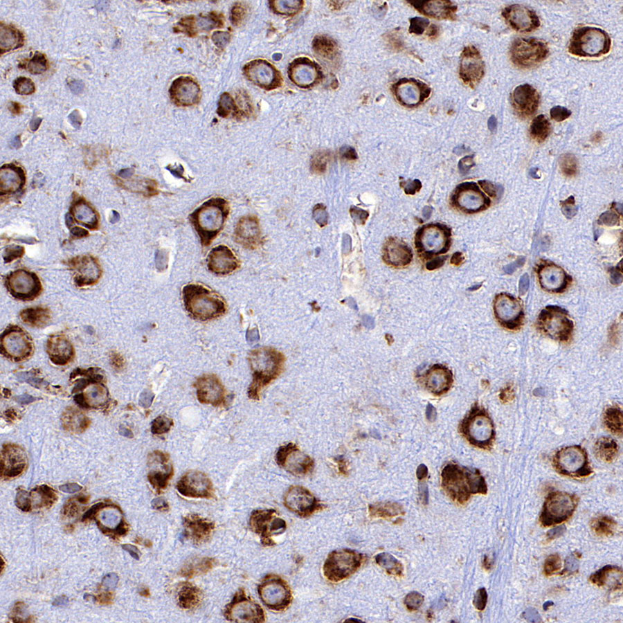 Rabbit anti-BID Recombinant Monoclonal Antibody(S-R300)