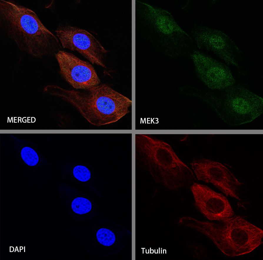 Rabbit anti-MEK3 Recombinant Monoclonal Antibody(S-835-23)