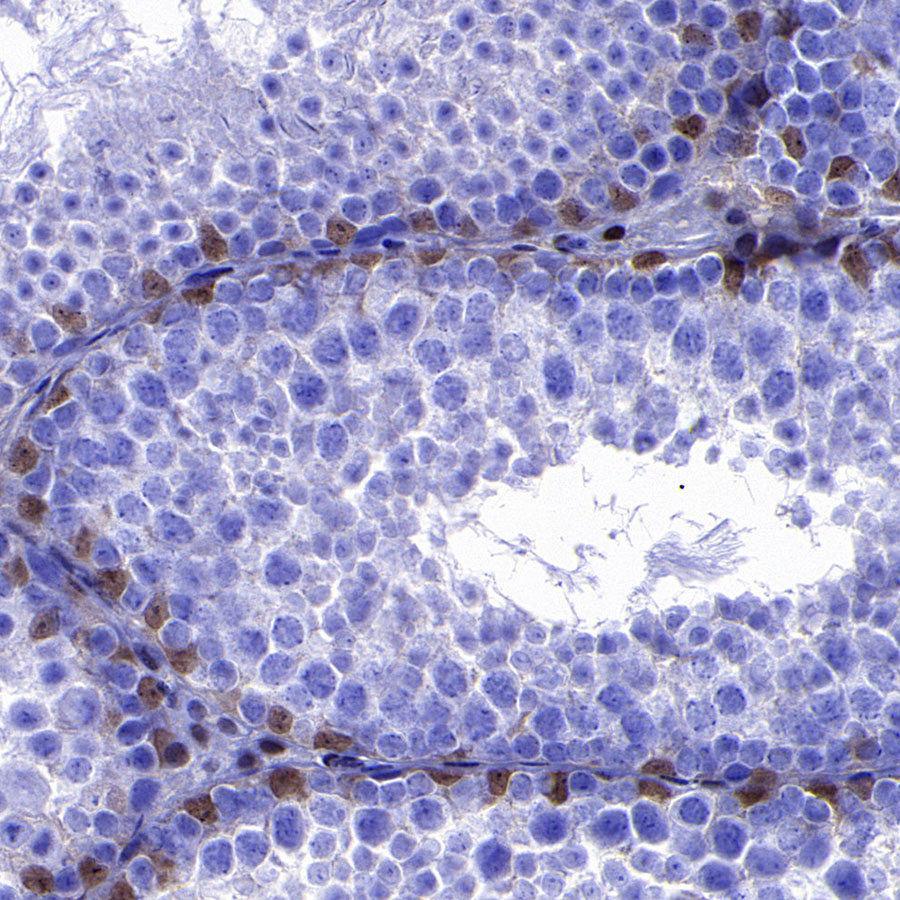 Rabbit anti-p27 Recombinant Monoclonal Antibody(S-141-135)