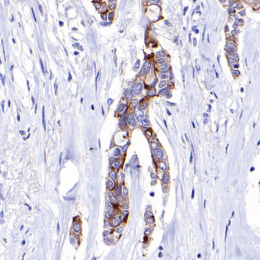 Rabbit anti-IGFBP2 Recombinant Monoclonal Antibody(S-808-24)