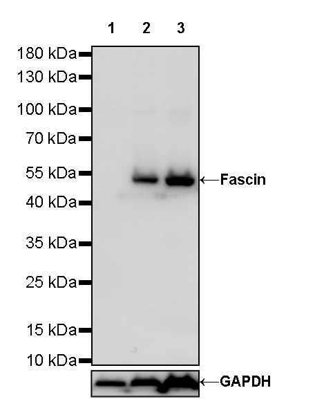 Rabbit anti-Fascin Recombinant Monoclonal Antibody(S-759-13)