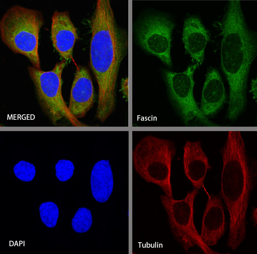 Rabbit anti-Fascin Recombinant Monoclonal Antibody(S-759-13)