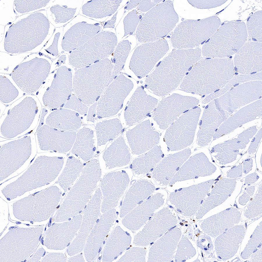 Rabbit anti-Fascin Recombinant Monoclonal Antibody(S-759-13)