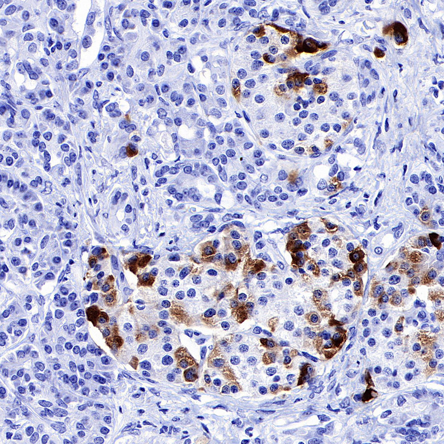 Rabbit anti-IGFBP2 Recombinant Monoclonal Antibody(S-808-24)