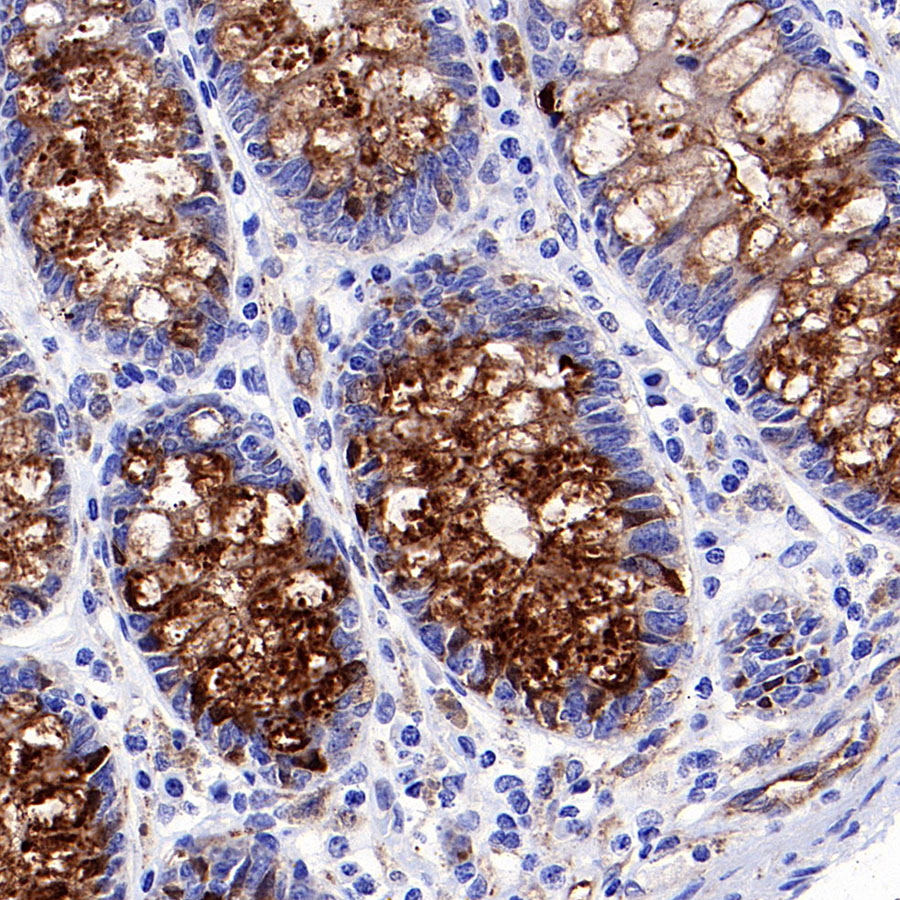 Rabbit anti-IGFBP2 Recombinant Monoclonal Antibody(S-808-24)