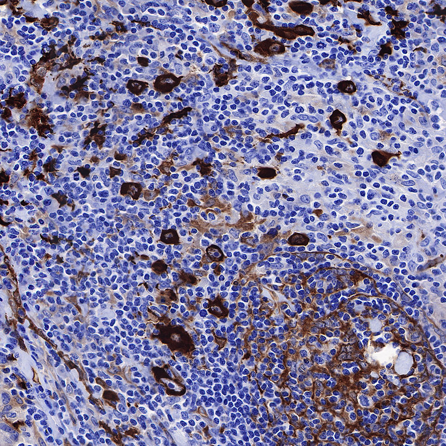 Rabbit anti-Fascin Recombinant Monoclonal Antibody(S-759-13)