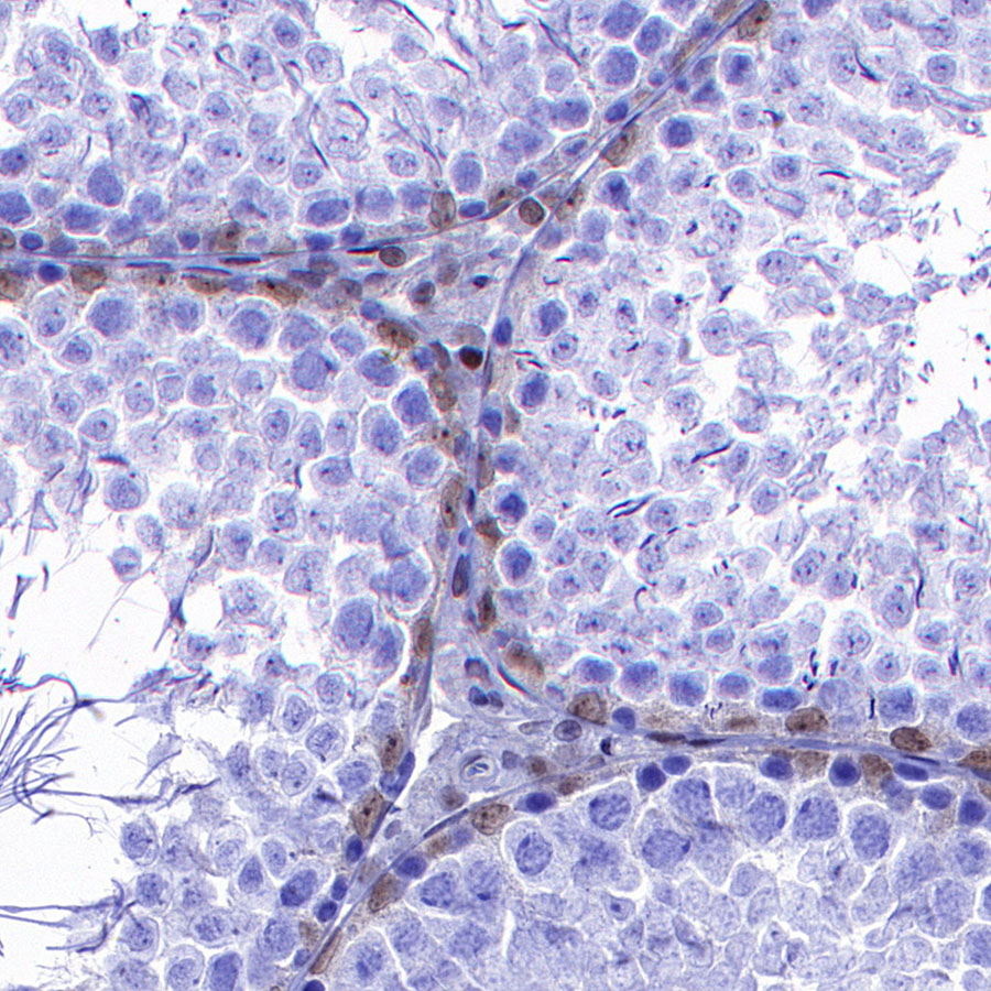 Rabbit anti-p27 Recombinant Monoclonal Antibody(S-141-135)