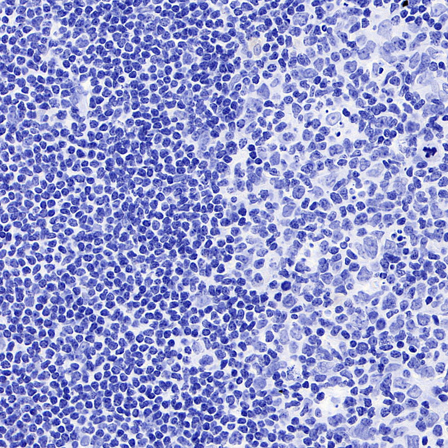 Rabbit anti-Luteinizing Hormone β Recombinant Monoclonal Antibody(545-2)