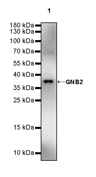 Rabbit anti-GNB2 Recombinant Monoclonal Antibody(S-645-10)