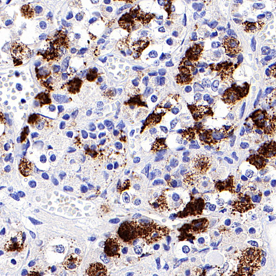 Rabbit anti-Luteinizing Hormone β Recombinant Monoclonal Antibody(545-2)
