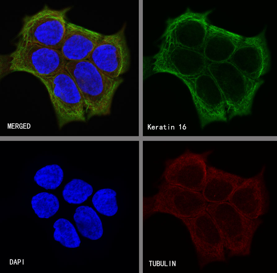 Rabbit anti-Keratin 16 Recombinant Monoclonal Antibody(S-R306)