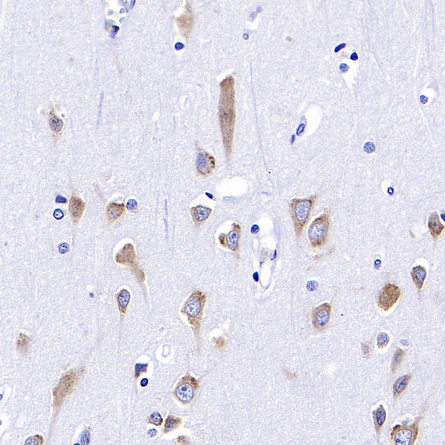 Rabbit anti-BID Recombinant Monoclonal Antibody(S-R300)